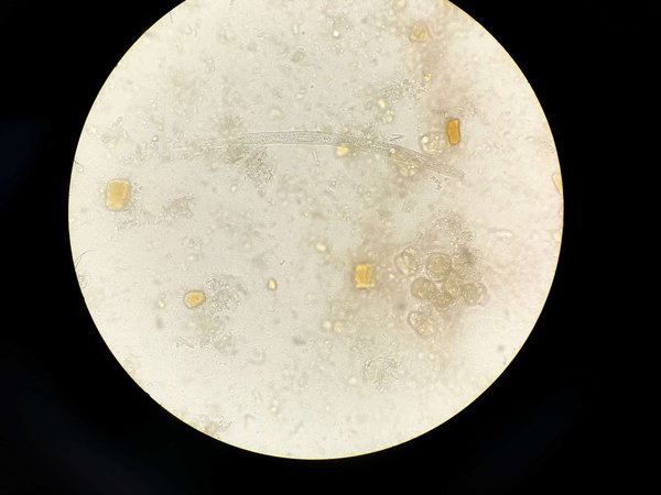 Comment identifier les parasites internes chez les chats et les traiter ?